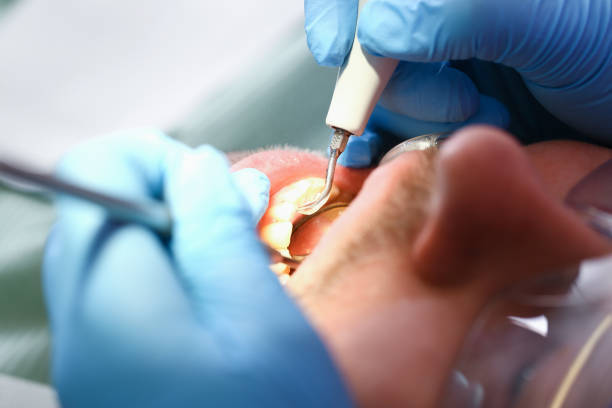 Best Same-Day Emergency Dentist in Fayetteville, AL