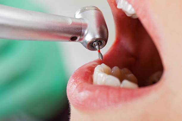 Best Emergency Dental Care for Trauma or Injury in Fayetteville, AL